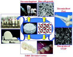  Zirconia:  เซรามิคขั้นสูงสำหรับการใช้งานในอุตสาหกรรมเครื่องจักรกลและการแพทย์!?